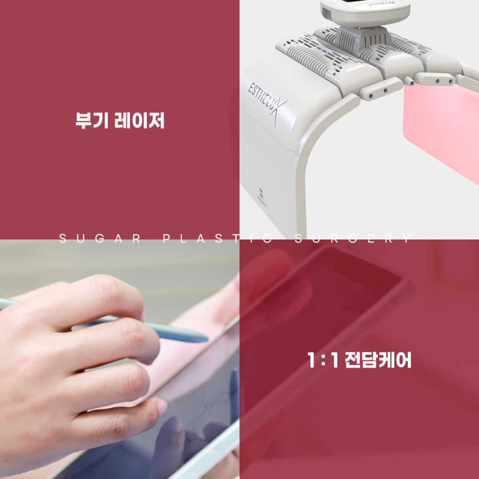 휜코 성형 알아보고 있다면 관련 이미지 14