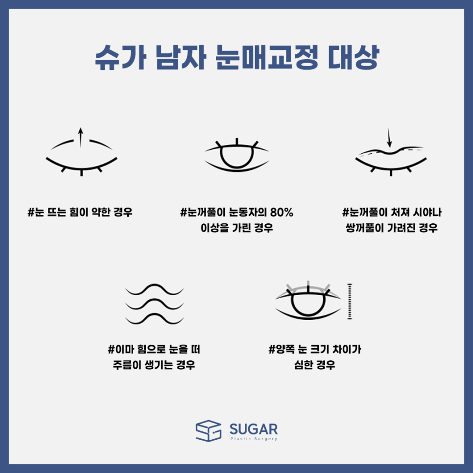 남자눈성형 뭐가 다를까? 관련 이미지 3