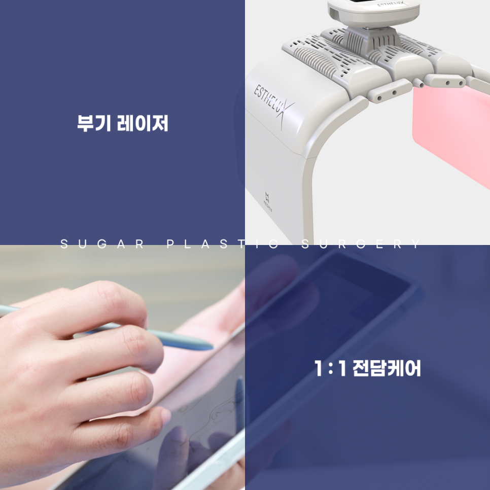 남자코수술 여자랑 어떻게 다를까 관련 이미지 14