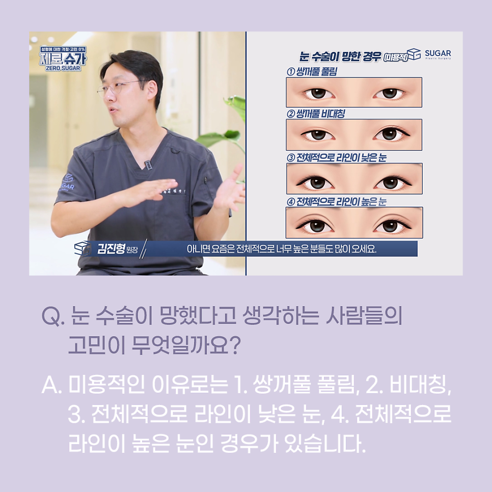 [슈가성형외과] 눈성형 실패하는 이유! 관련 이미지 2