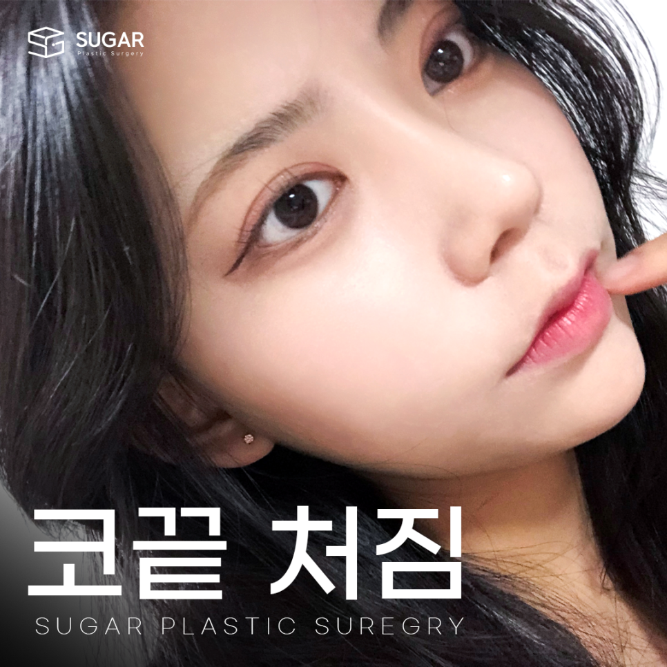 코끝 처짐 원인과 해결 관련 이미지 1