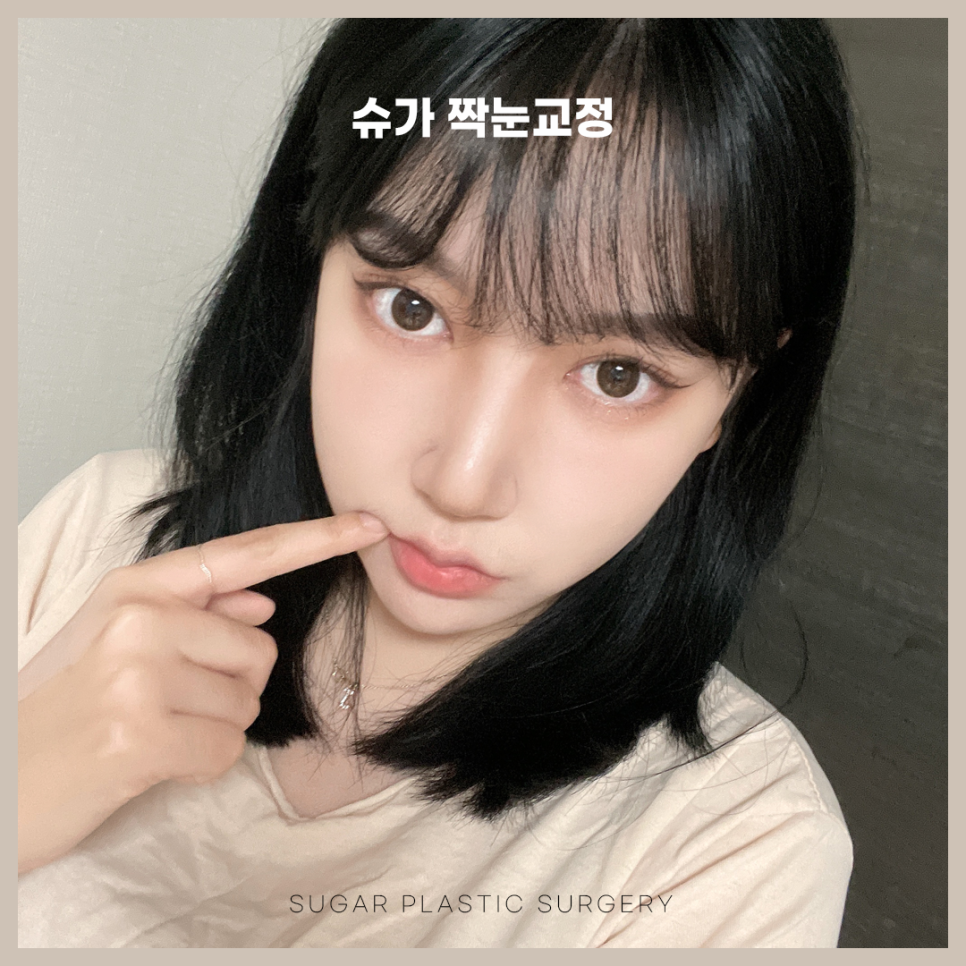 짝눈교정 어떻게 알아볼까 관련 이미지 3