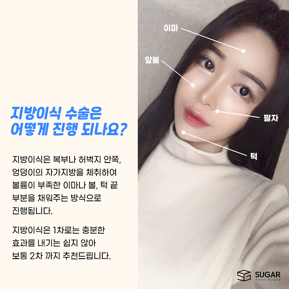 지방이식 vs 필러 어떤게 좋을까 관련 이미지 3