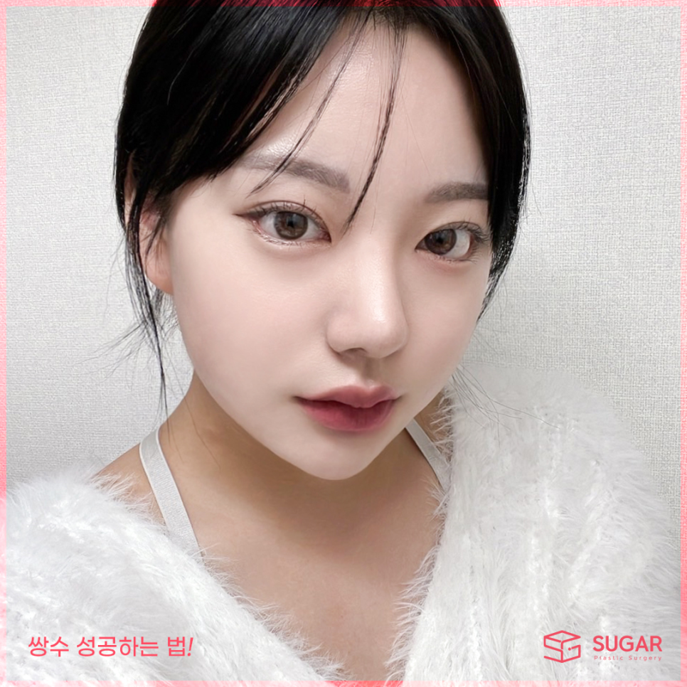쌍수 성공하는 방법! 관련 이미지 2