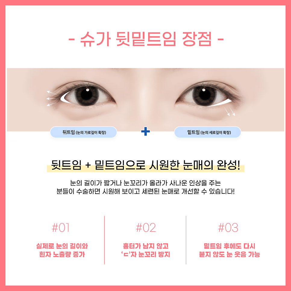 뒷밑트임 붙을까봐 걱정이라면? 관련 이미지 4