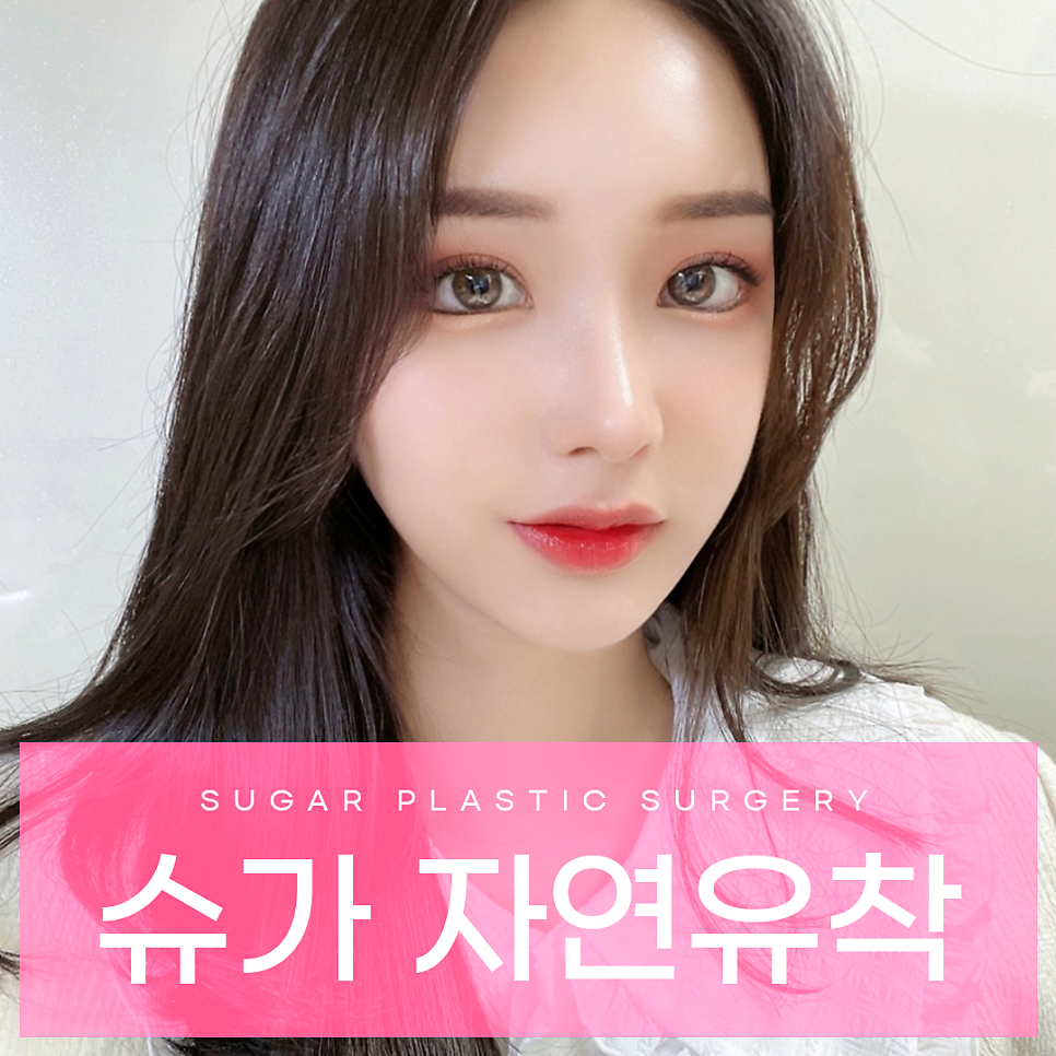 자연유착 이름부터 특징까지 총정리 관련 이미지 1