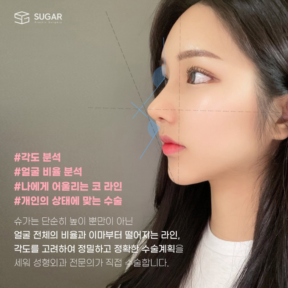 코성형후기 어떻게 알아볼까요? 관련 이미지 5