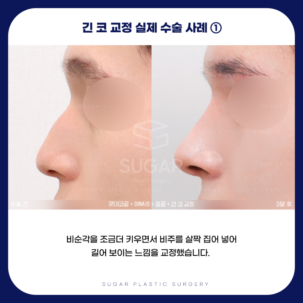 긴코 VS 짧은코 관련 이미지 8