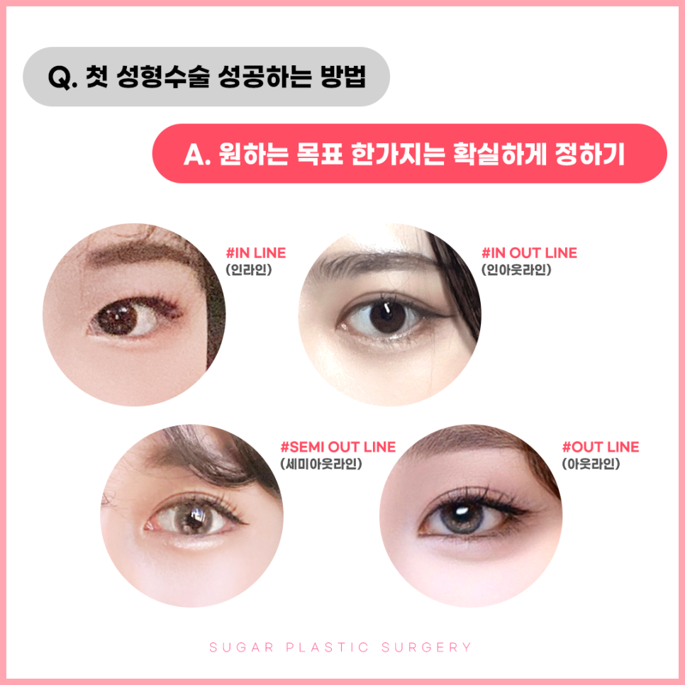 쌍수 성공하는 방법! 관련 이미지 3