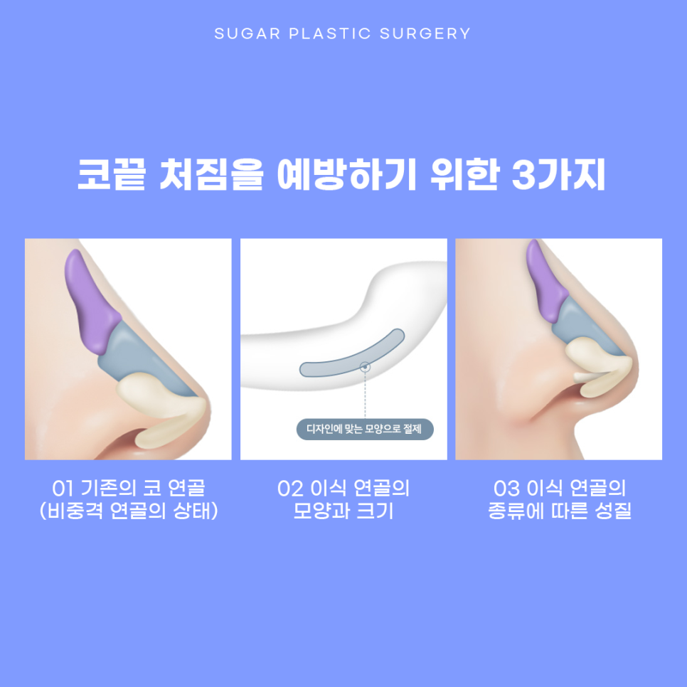 코끝 처짐 원인과 해결 관련 이미지 5