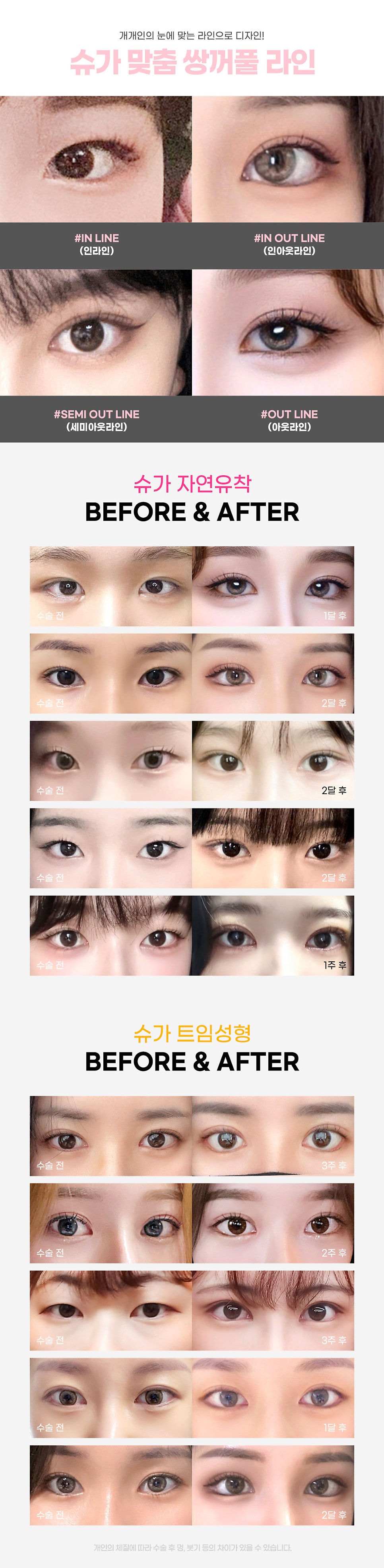 2023년도 슈가성형외과 수험생 이벤트 관련 이미지 3