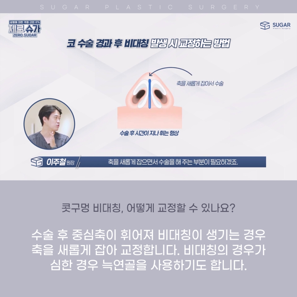 코 성형 후 콧구멍 짝짝이가 되었다?! 관련 이미지 10