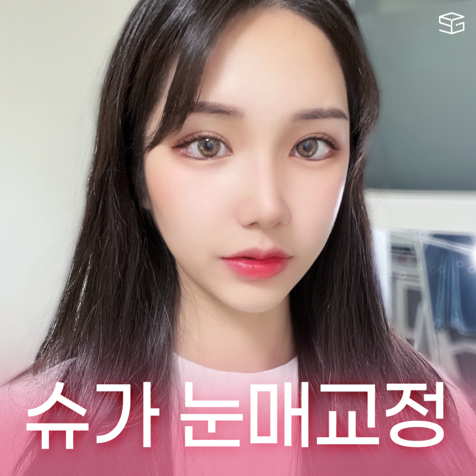 비절개눈매교정 VS 절개눈매교정 관련 이미지 1