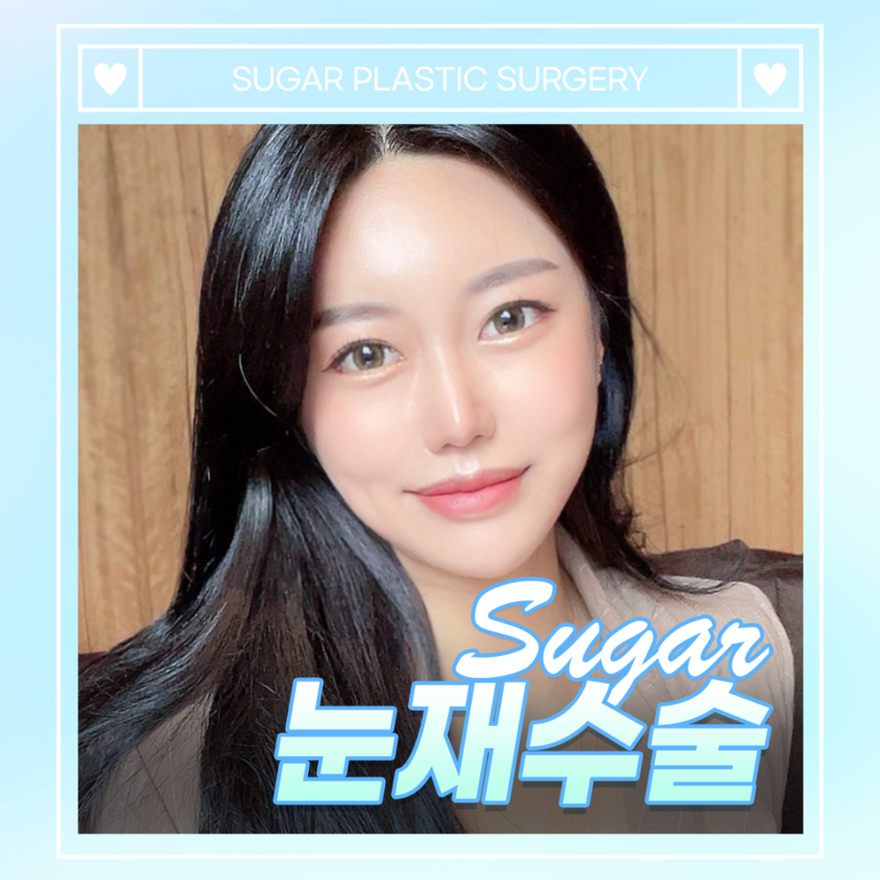 눈재수술 이거 내 얘긴데? 관련 이미지 1