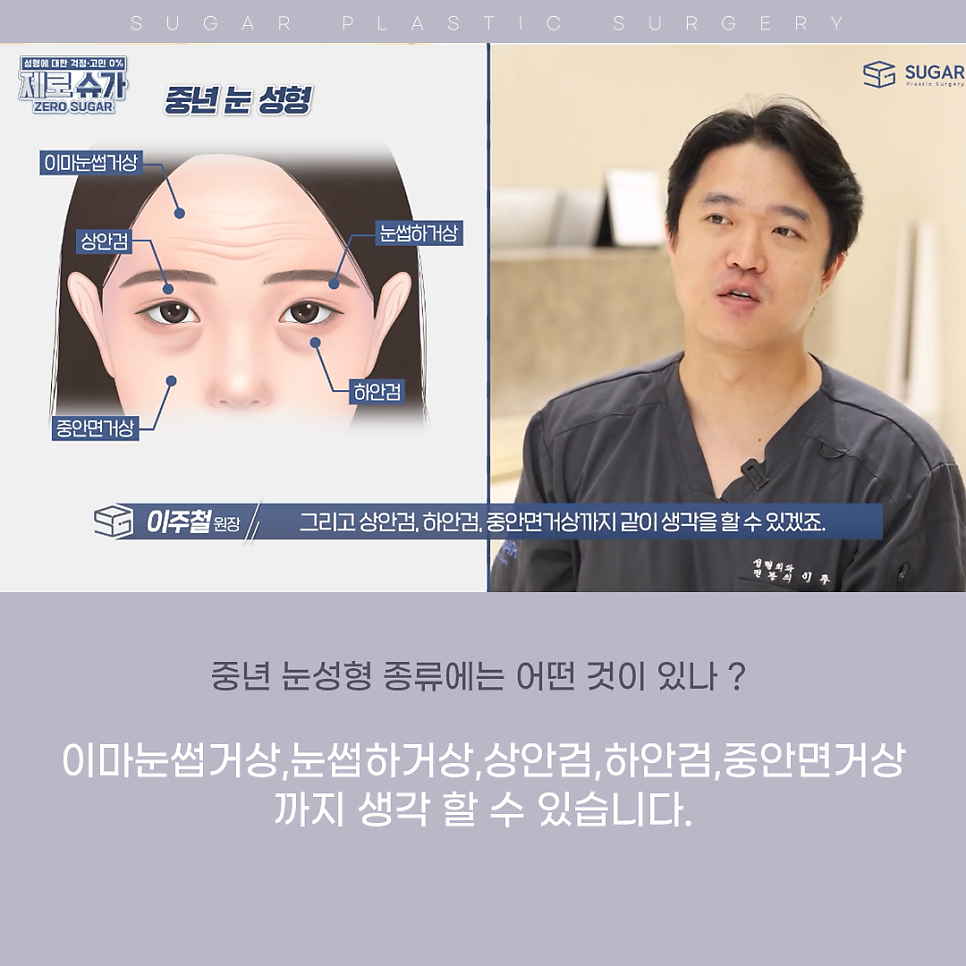 처짐과의 전쟁,중년 눈성형! 나에게 딱 맞는 수술은 관련 이미지 3