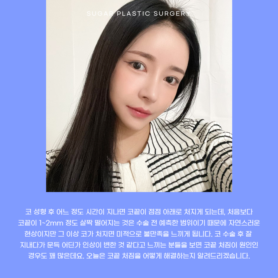 코끝 처짐 원인과 해결 관련 이미지 2