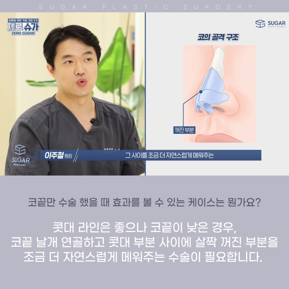 코끝만 올려주세요(feat 무보형물 코성형) 관련 이미지 4