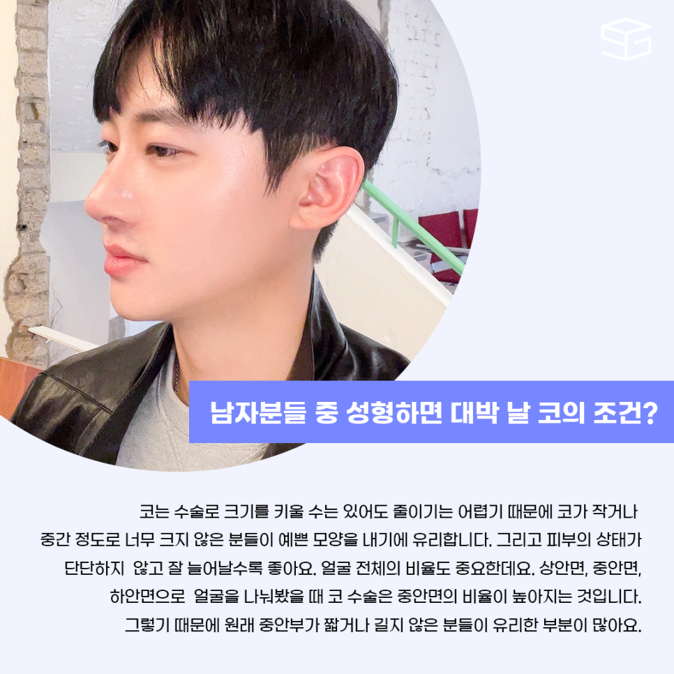 남자성형 대박나는 조건 관련 이미지 3