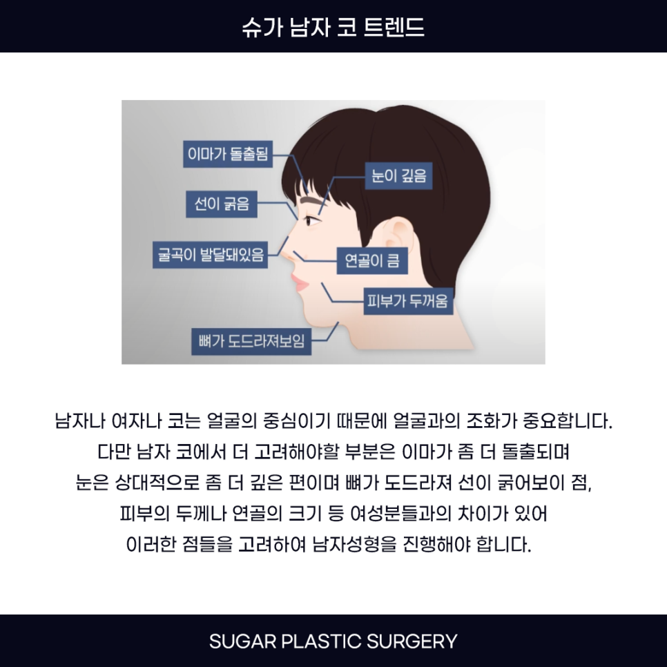 남자코성형 트렌드 확인하기 관련 이미지 2