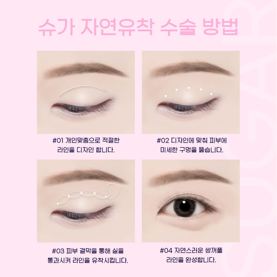 자연유착 이름부터 특징까지 총정리 관련 이미지 8