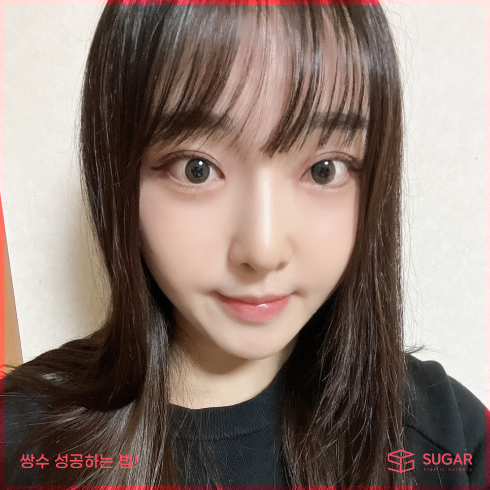 쌍수 성공하는 방법! 관련 이미지 7