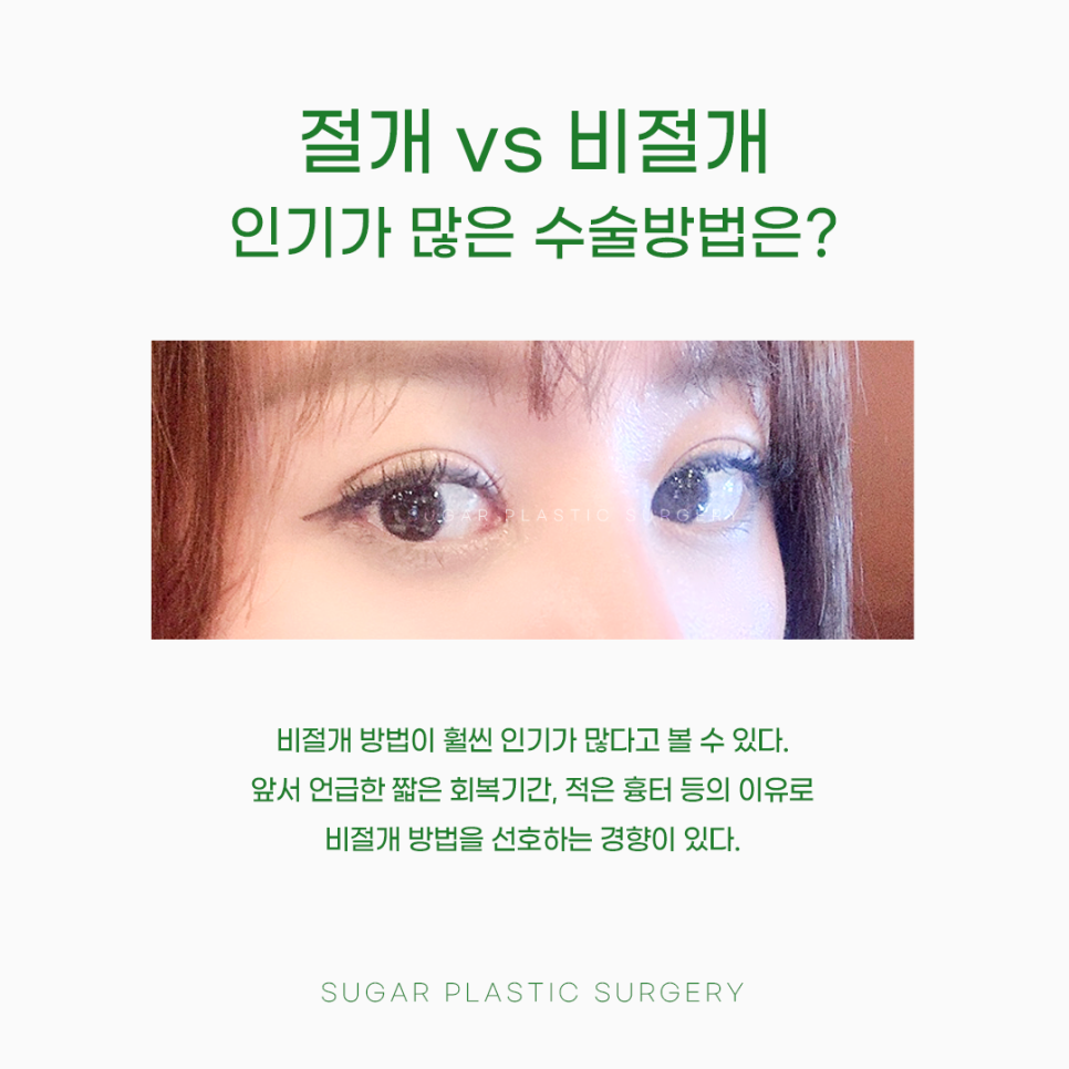 절개 비절개 나에게 맞는 방법은? 관련 이미지 6