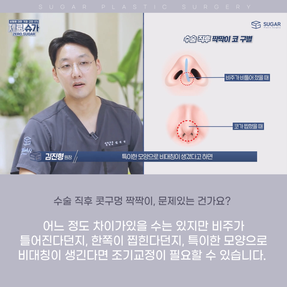 코 성형 후 콧구멍 짝짝이가 되었다?! 관련 이미지 3