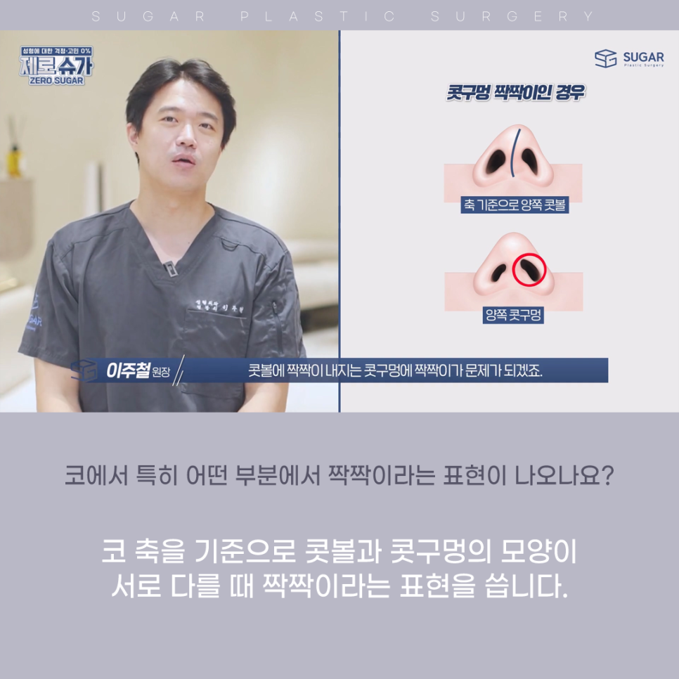 코 성형 후 콧구멍 짝짝이가 되었다?! 관련 이미지 2