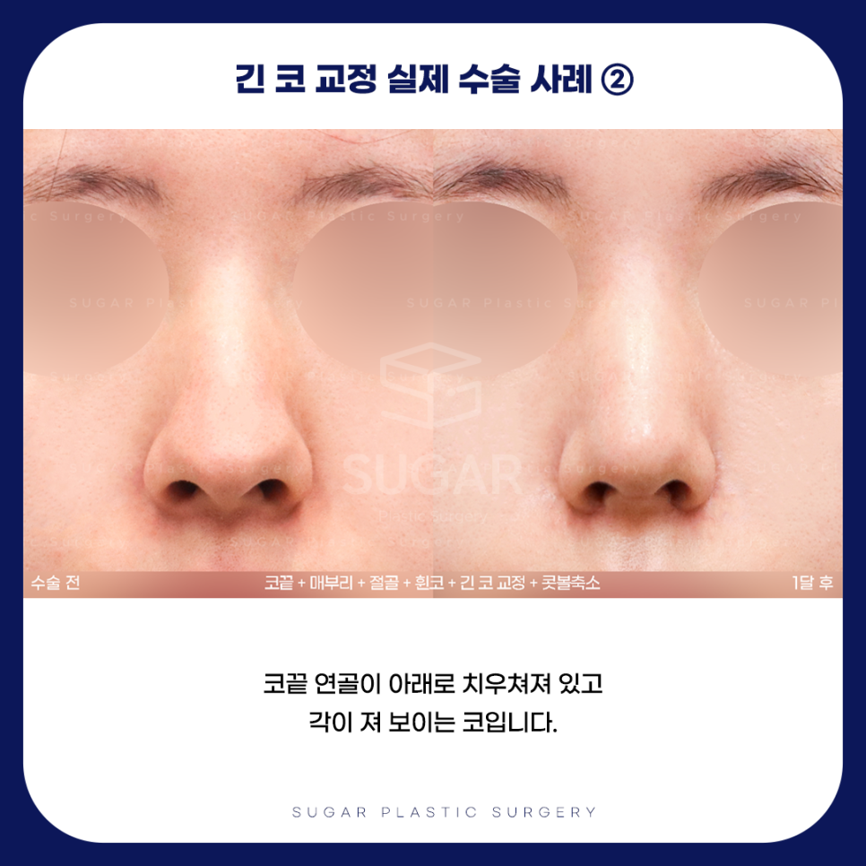 긴코 VS 짧은코 관련 이미지 9