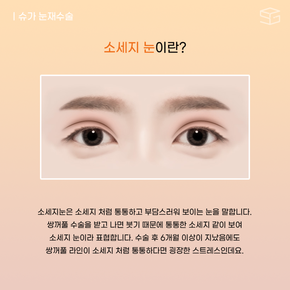 두줄따기 고민된다면? 관련 이미지 2