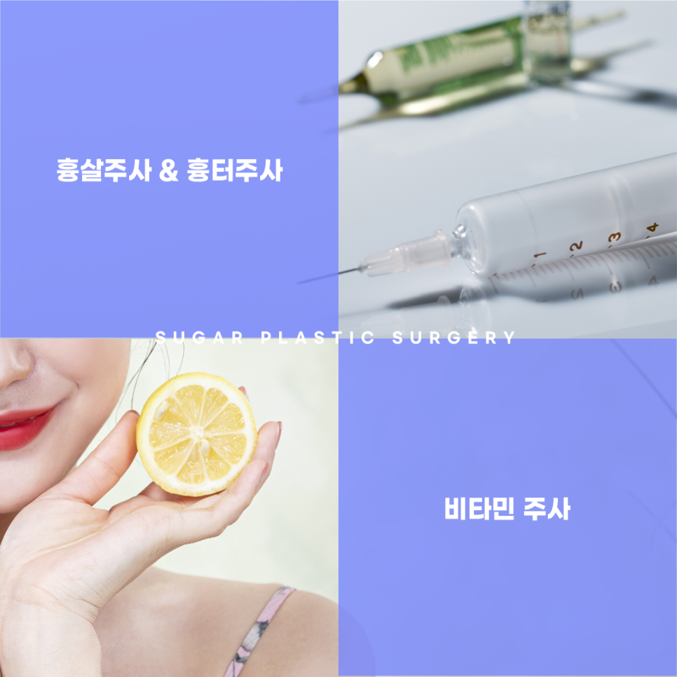 남자성형 대박나는 조건 관련 이미지 14