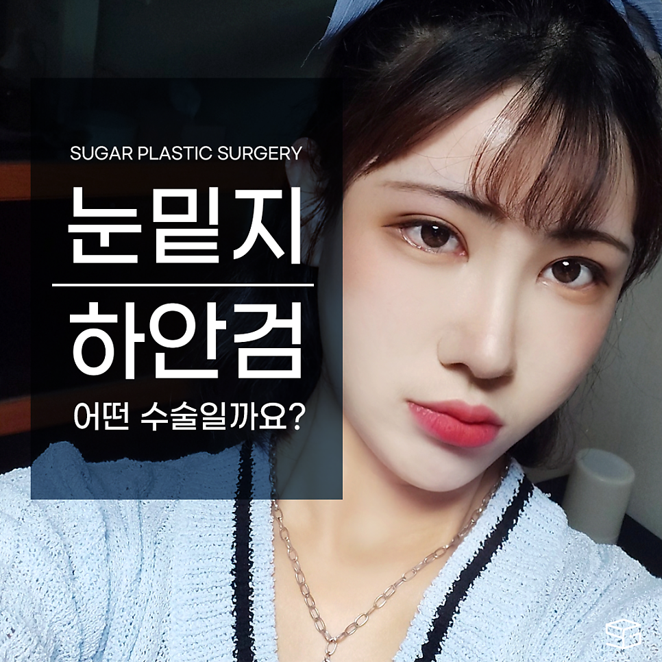 눈밑지방재배치 그 방법과 효과 관련 이미지 1