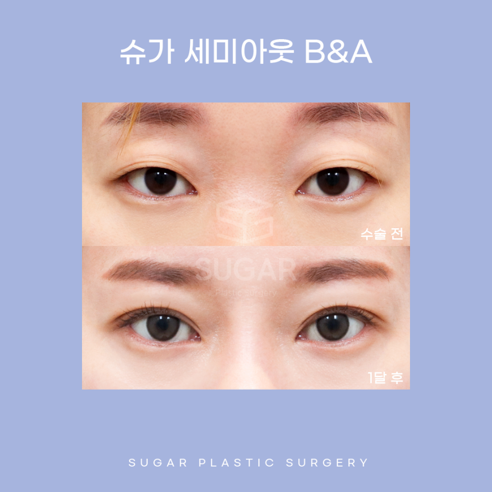 자연화려한 세미아웃 라인 관련 이미지 5