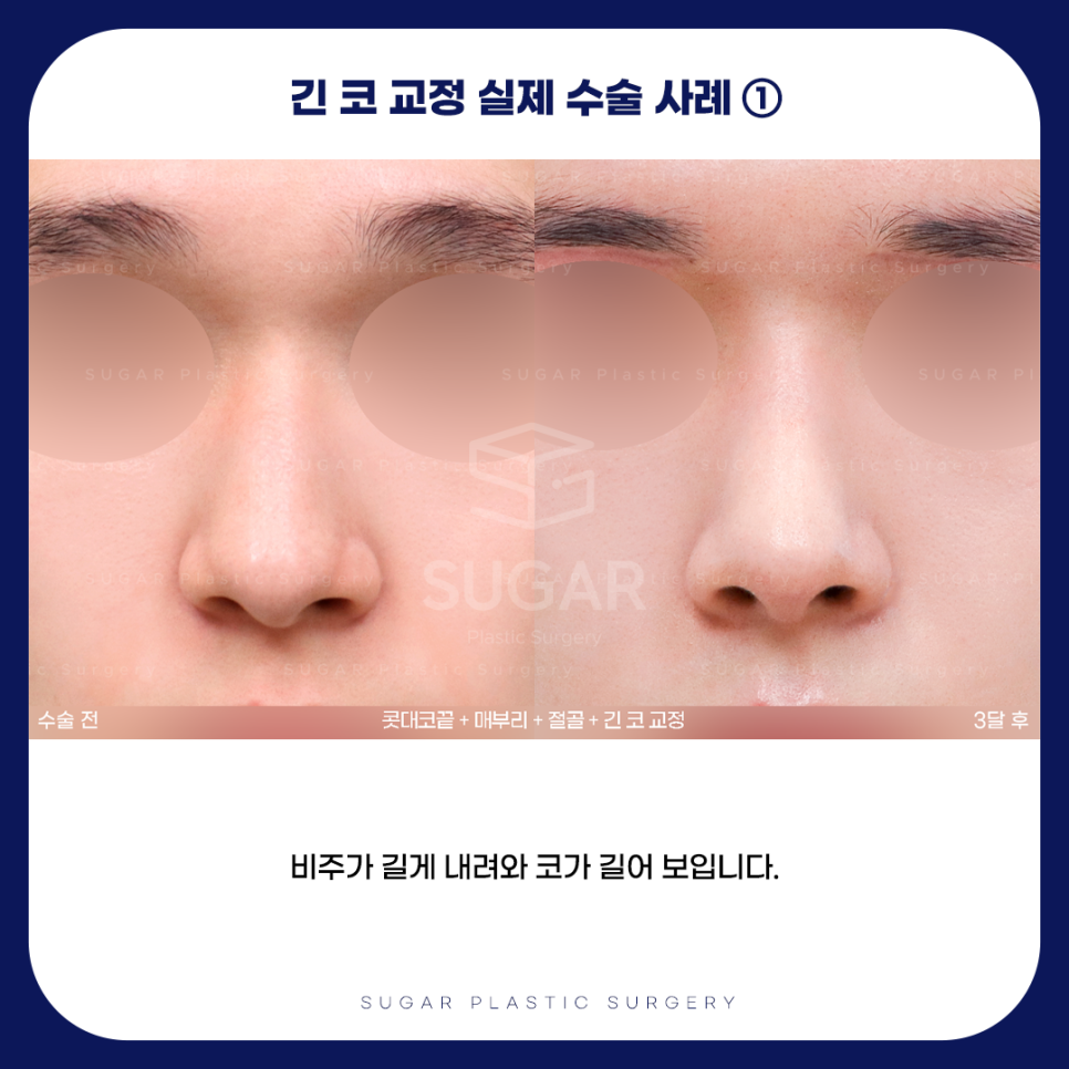 긴코 VS 짧은코 관련 이미지 6