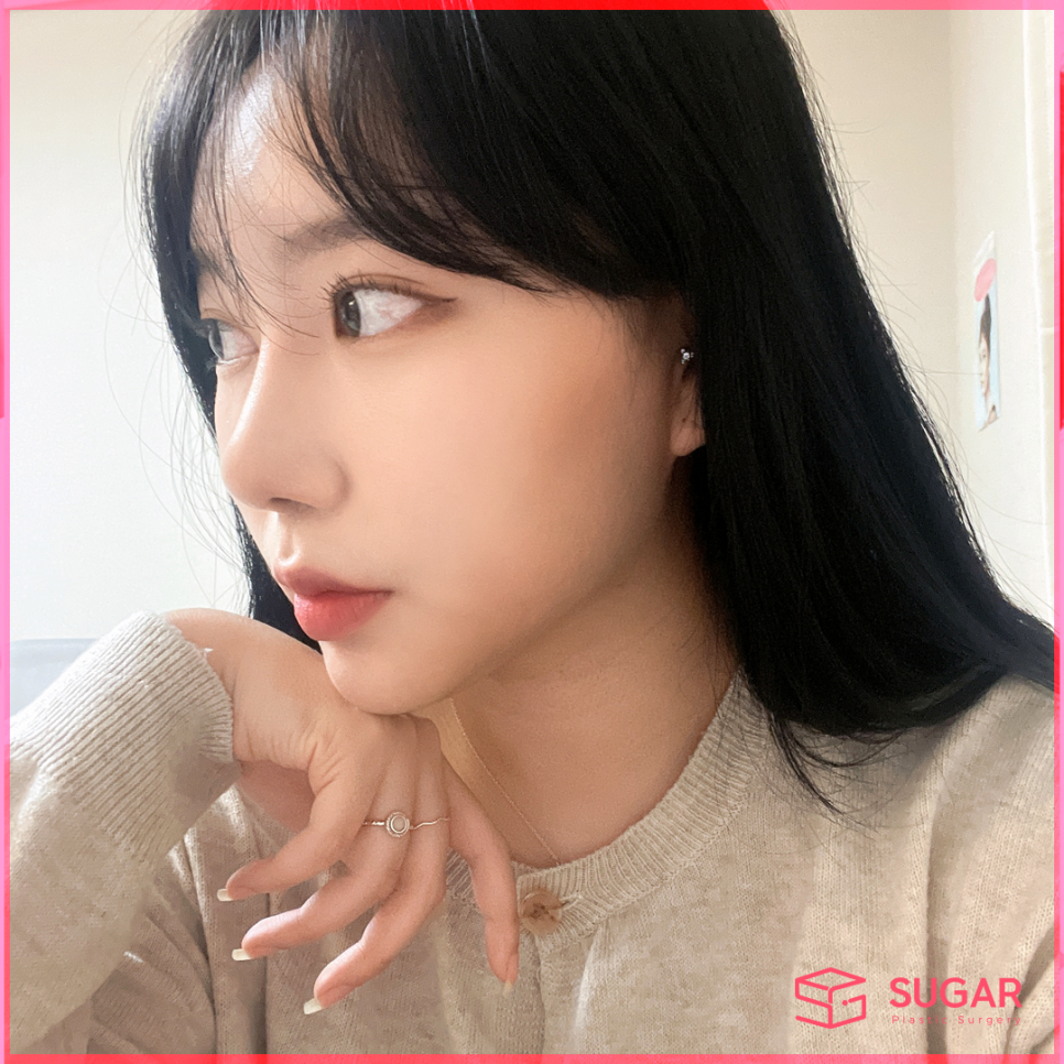 코성형 대박나는 코 관련 이미지 12