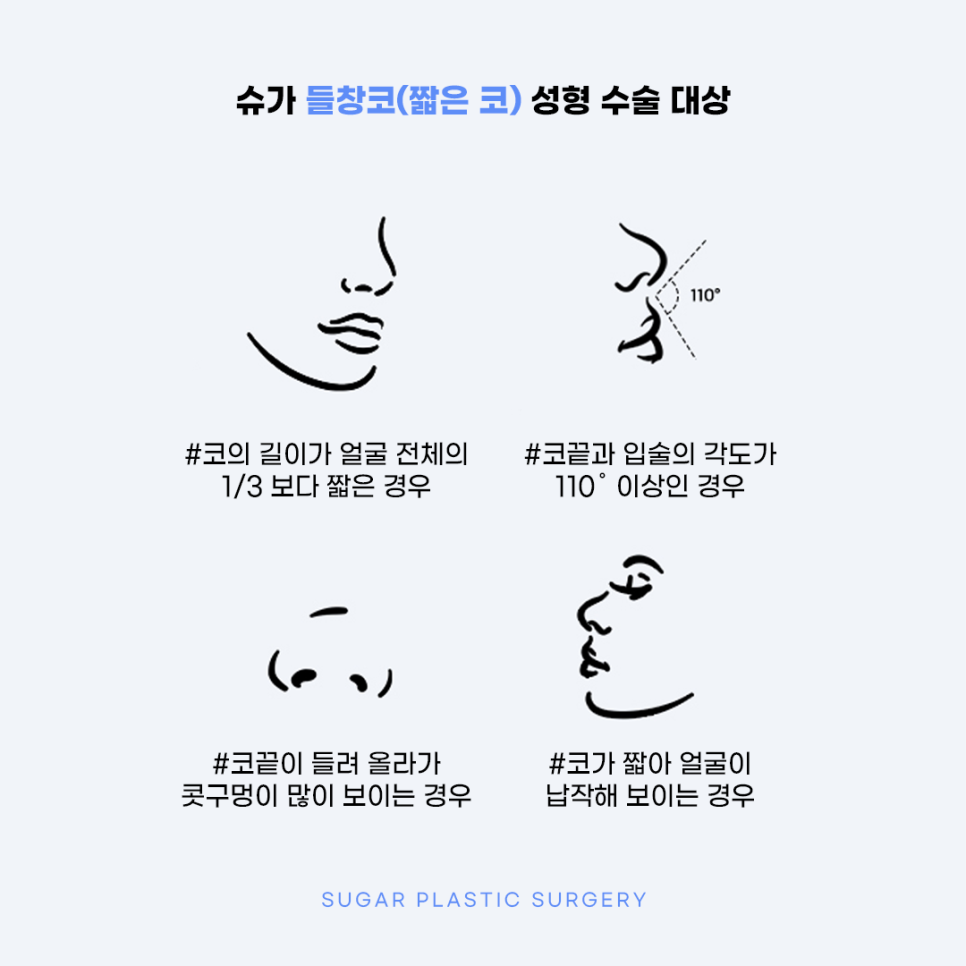 들창코 그 원인과 해결방법 관련 이미지 7