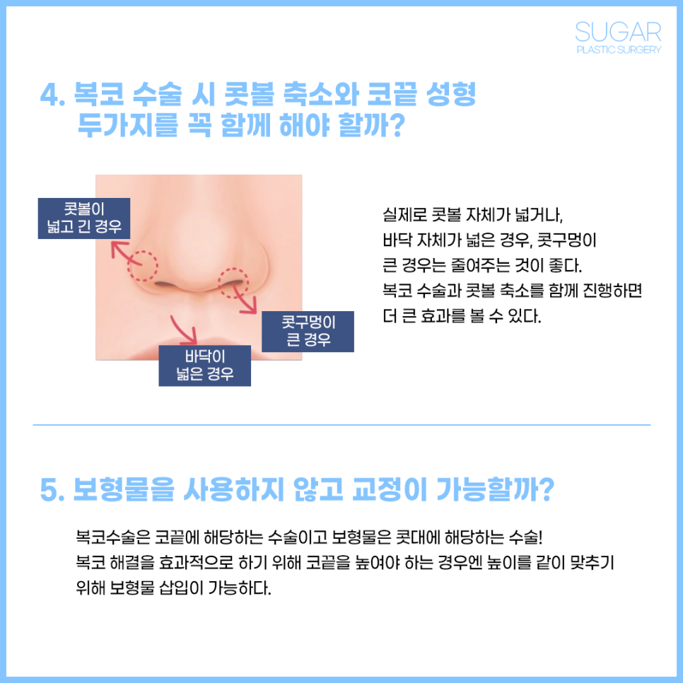 복코수술 유형에 따른 수술방법 관련 이미지 4