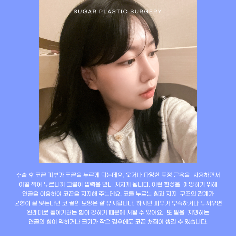코끝 처짐 원인과 해결 관련 이미지 3