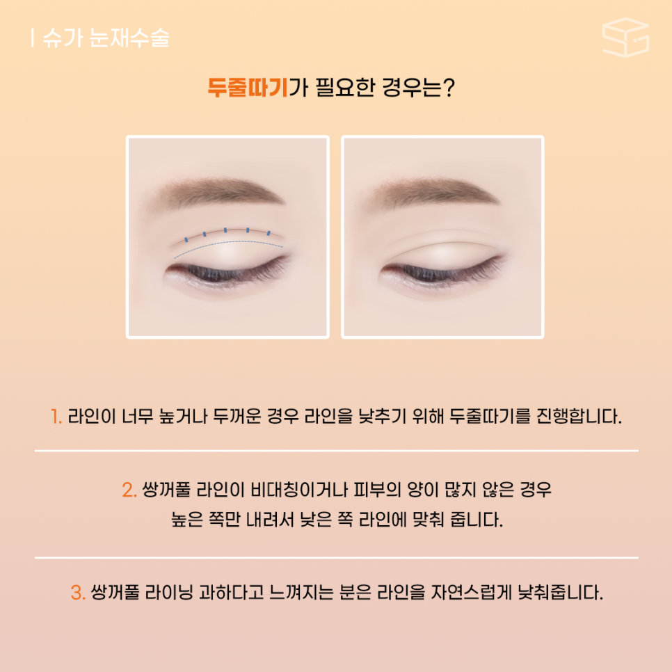 두줄따기 고민된다면? 관련 이미지 4
