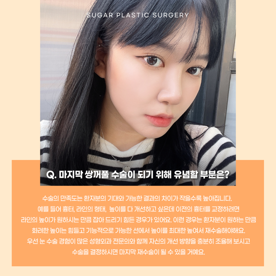 눈재수술 최대 몇 번까지 가능할까? 관련 이미지 12