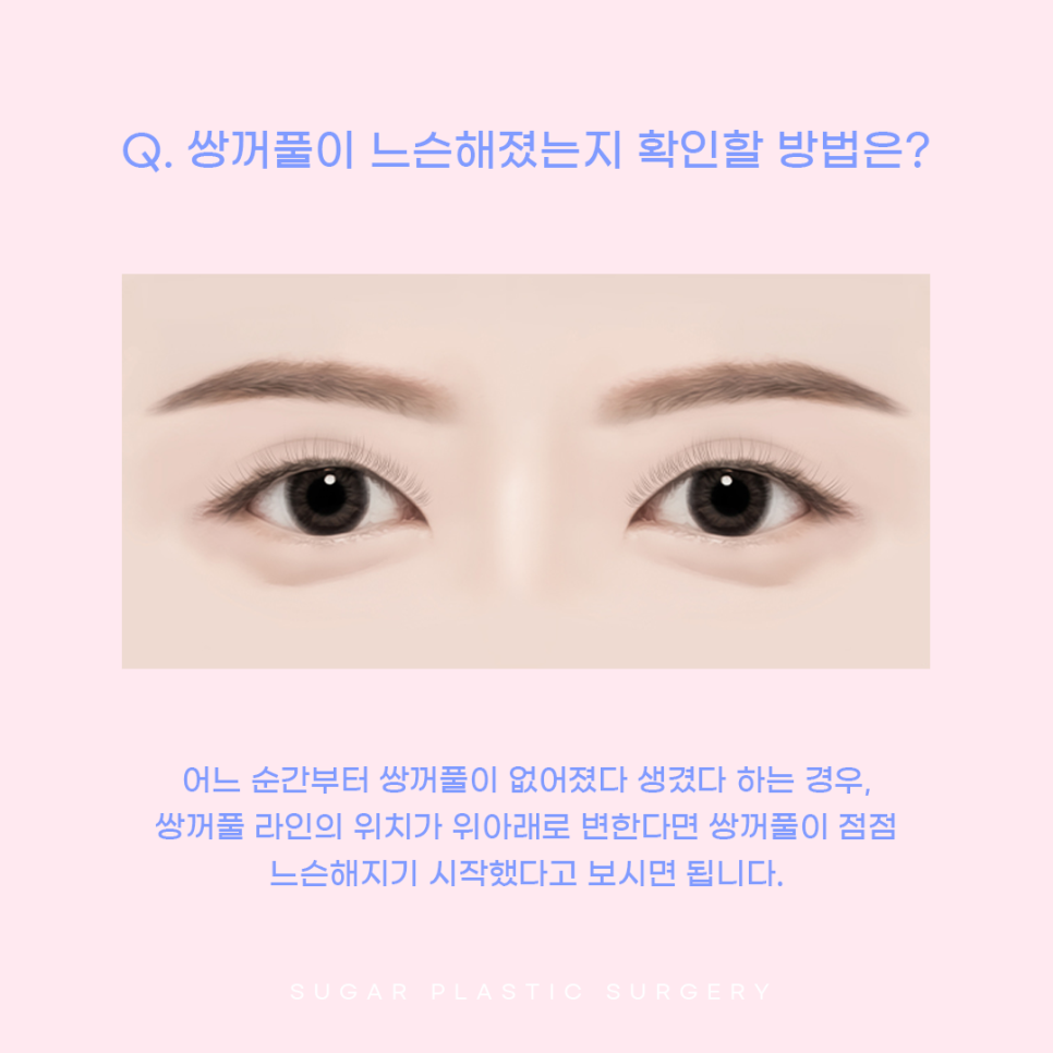 눈재수술 비절개로 가능할까? 관련 이미지 4