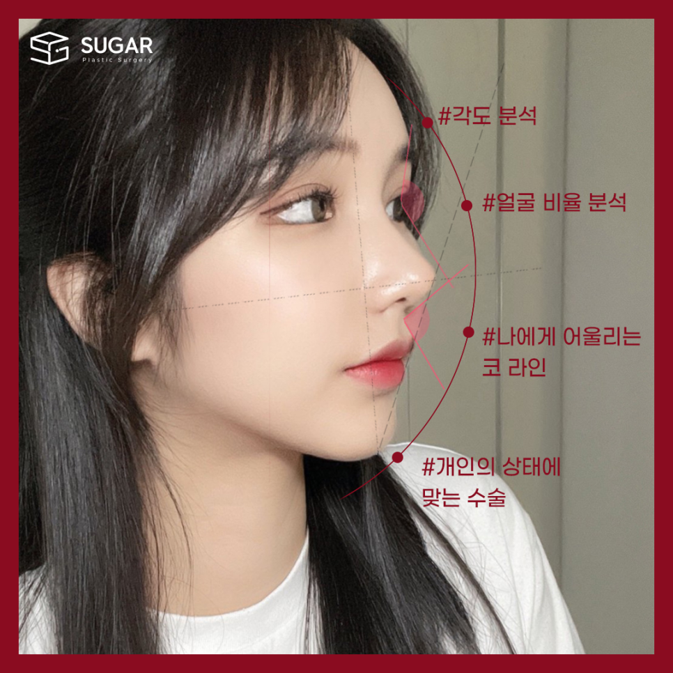 휜코 성형 알아보고 있다면 관련 이미지 2