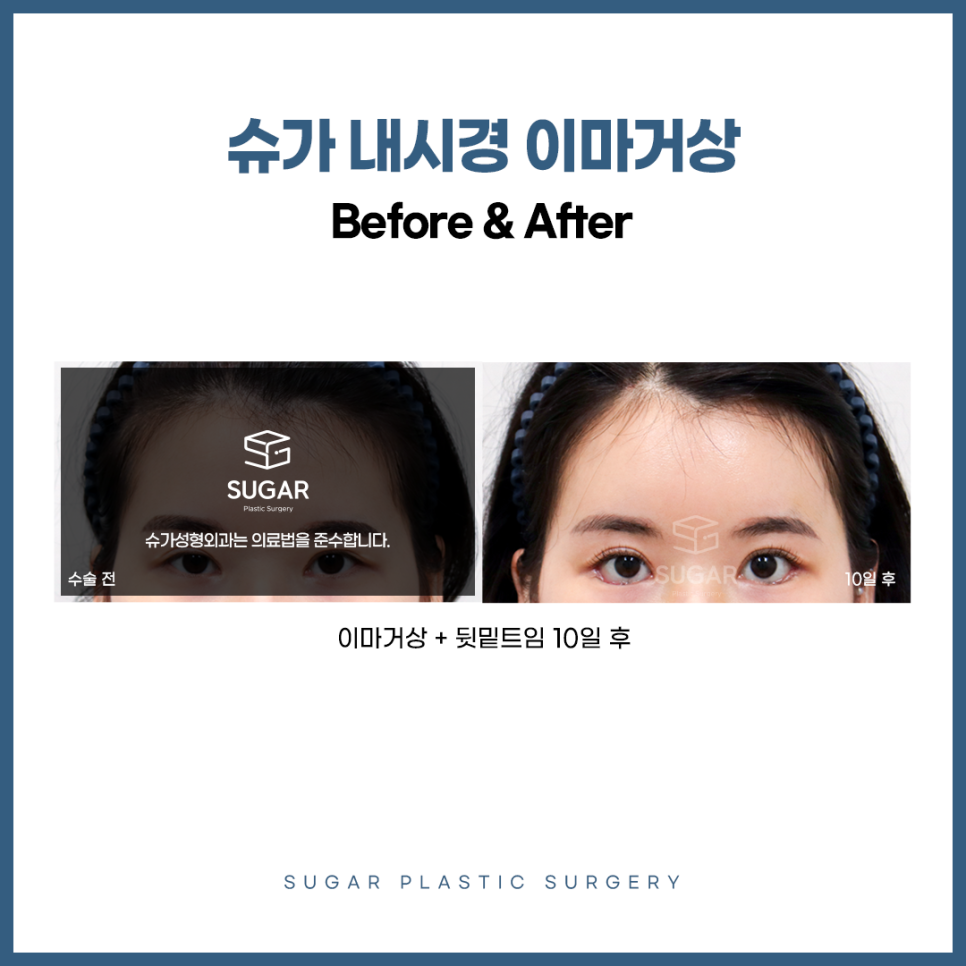 이마거상 어떤 사람한테 적합할까? 관련 이미지 4