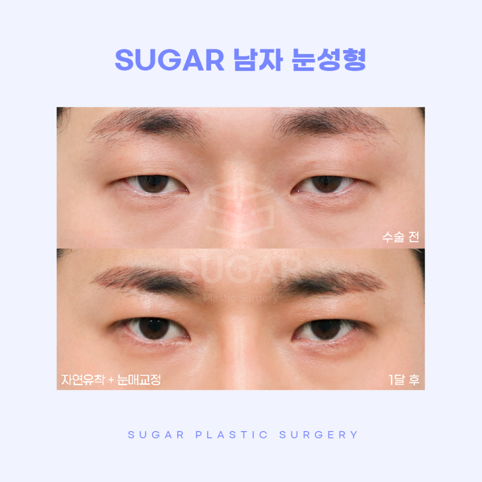 남자성형 대박나는 조건 관련 이미지 7