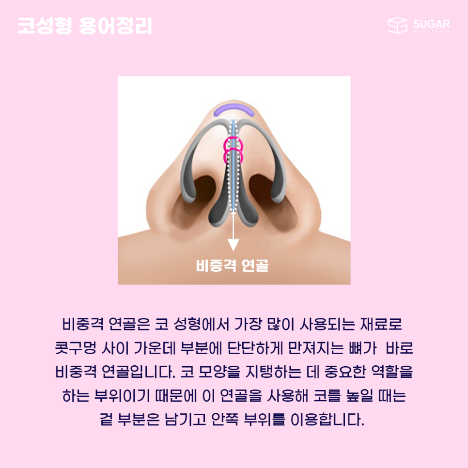 코성형 처음이라면? 용어정리! 관련 이미지 2