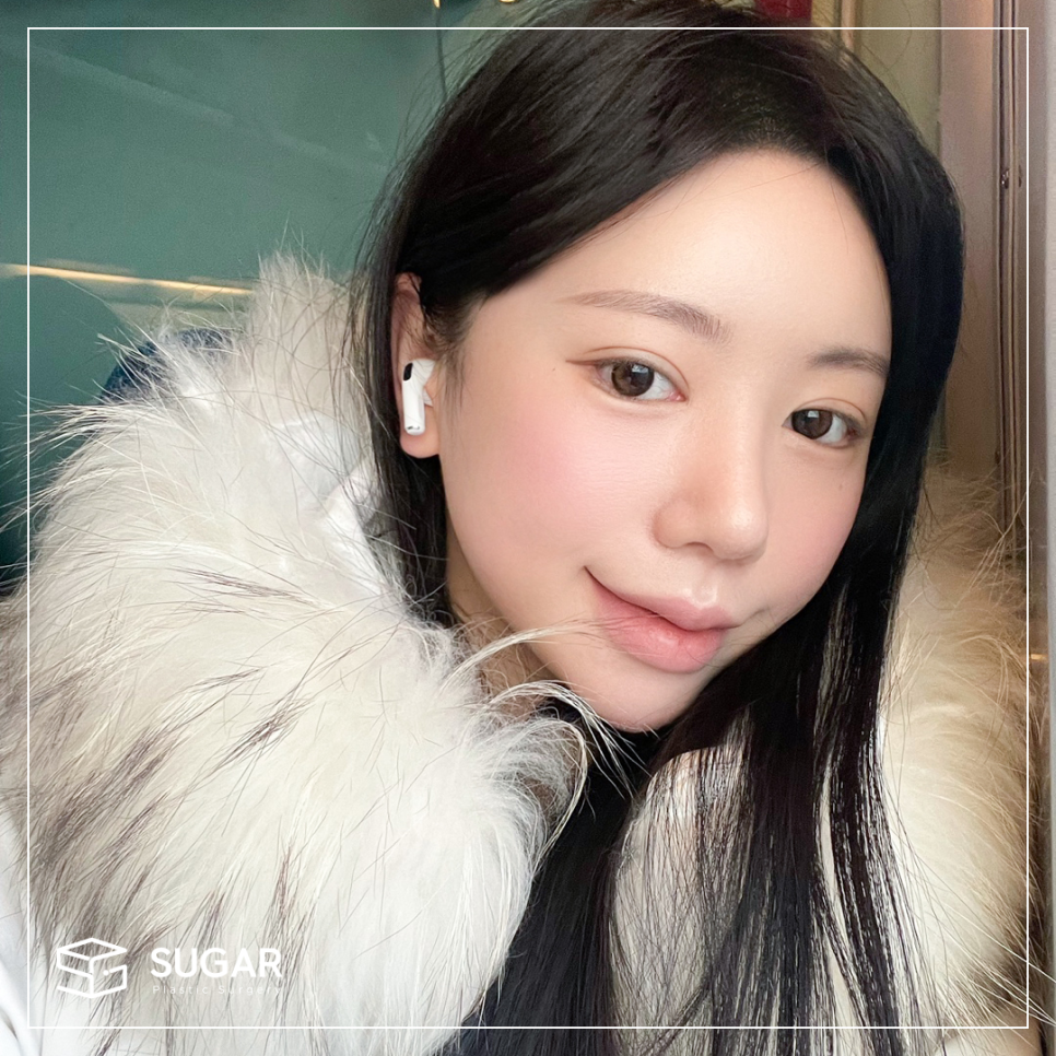 눈재수술 비절개로 가능할까? 관련 이미지 7