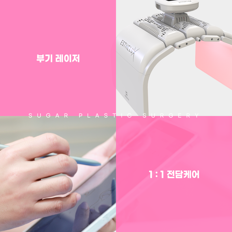 자연유착 이름부터 특징까지 총정리 관련 이미지 7