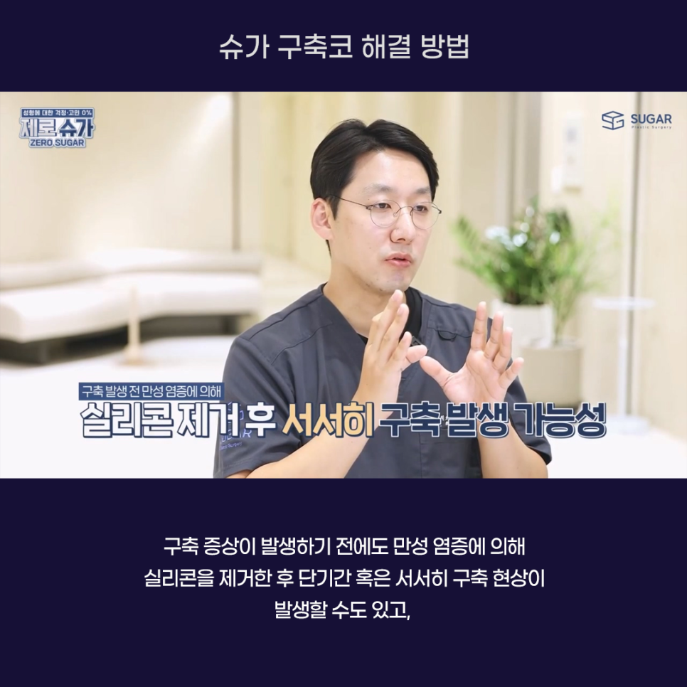 코재수술의 끝판왕, 구축코 케이스와 해결방법 관련 이미지 3