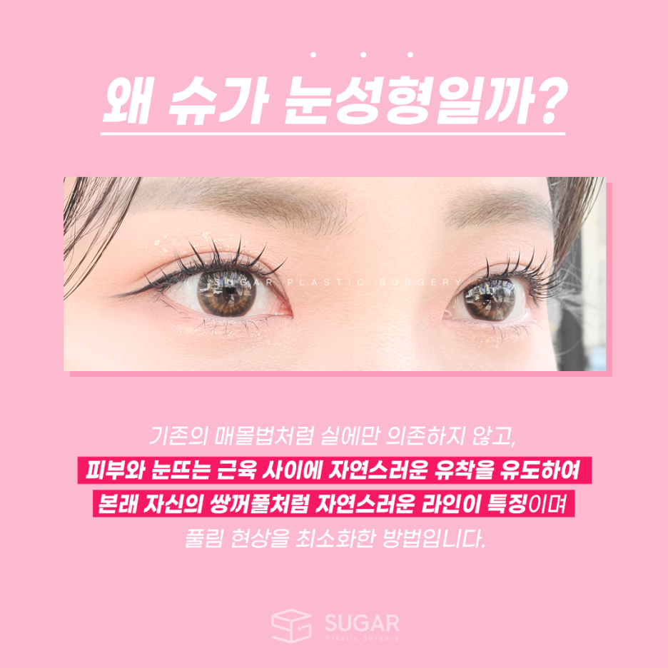 쌍꺼풀라인, 내가 원하는 라인으로 가능할까? 관련 이미지 2