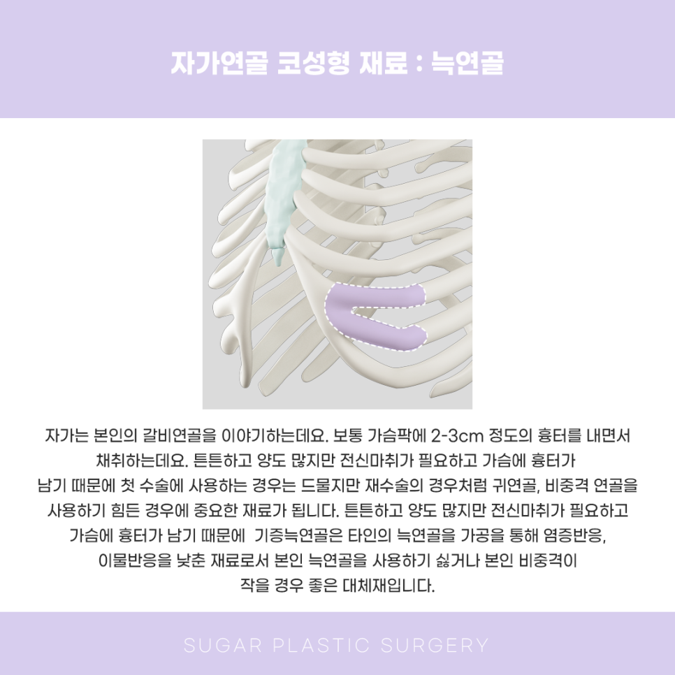 코성형 재료 다 알려드림 관련 이미지 6